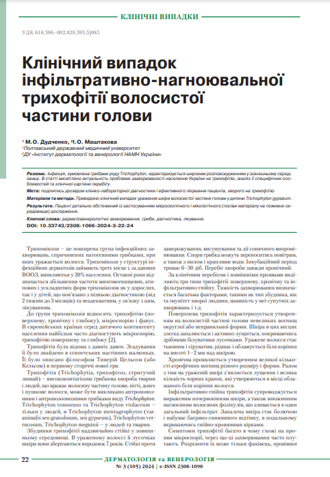 Ескіз