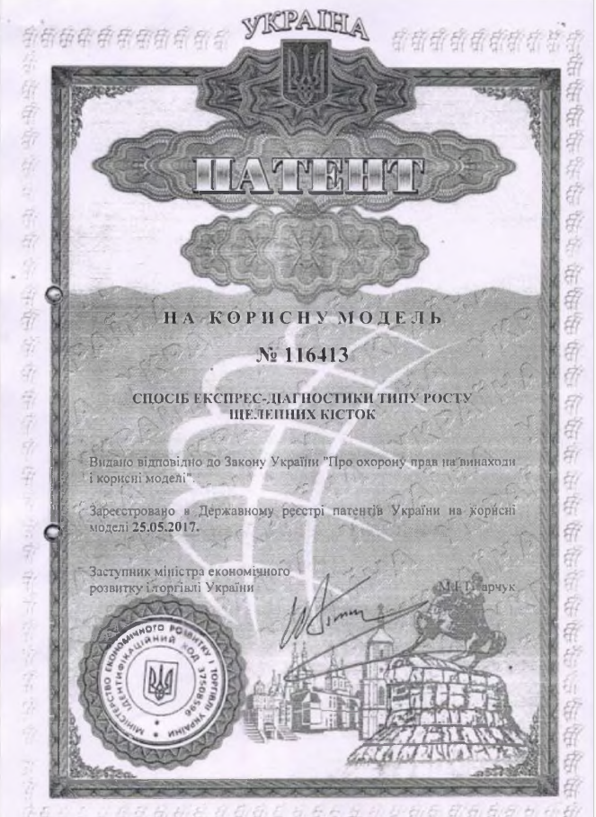 Ескіз