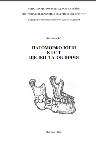 Ескіз